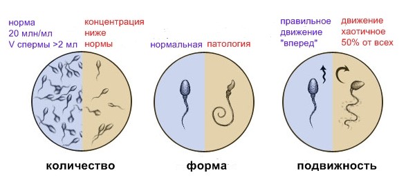 Что показывает анализ спермы – спермограмма?